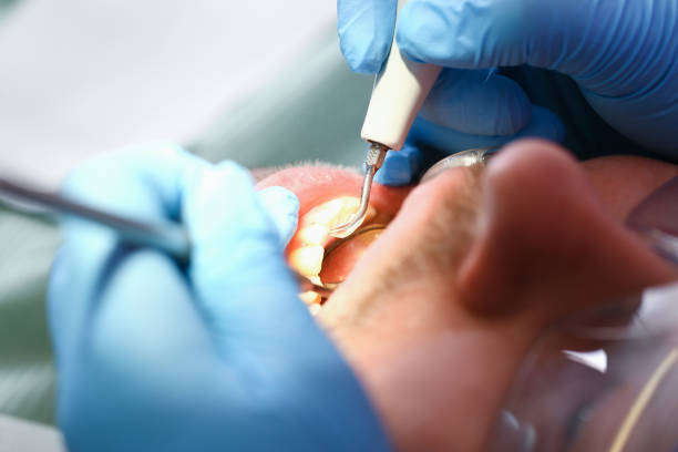 Best Knocked-Out Tooth Emergency  in Eielson Af, AK